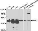 AEBP2 Antibody in Western Blot (WB)