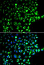 RAB31 Antibody in Immunocytochemistry (ICC/IF)