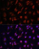 TET3 Antibody in Immunocytochemistry (ICC/IF)