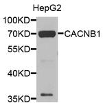 CACNB1 Antibody in Western Blot (WB)