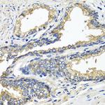 ETFA Antibody in Immunohistochemistry (Paraffin) (IHC (P))