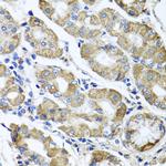 ETFA Antibody in Immunohistochemistry (Paraffin) (IHC (P))