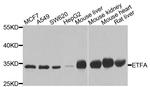 ETFA Antibody in Western Blot (WB)