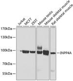 INPP4A Antibody in Western Blot (WB)