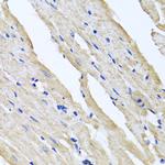 RCN2 Antibody in Immunohistochemistry (Paraffin) (IHC (P))