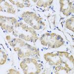 RCN2 Antibody in Immunohistochemistry (Paraffin) (IHC (P))