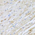 STRN Antibody in Immunohistochemistry (Paraffin) (IHC (P))