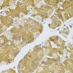 NAT8 Antibody in Immunohistochemistry (Paraffin) (IHC (P))