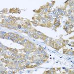 COQ7 Antibody in Immunohistochemistry (Paraffin) (IHC (P))