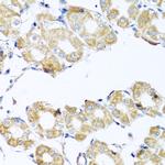 COQ7 Antibody in Immunohistochemistry (Paraffin) (IHC (P))