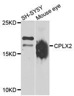 CPLX2 Antibody in Western Blot (WB)