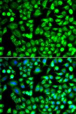 ALKBH4 Antibody in Immunocytochemistry (ICC/IF)