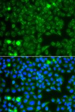 GBA3 Antibody in Immunocytochemistry (ICC/IF)