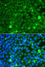 GBA3 Antibody in Immunocytochemistry (ICC/IF)