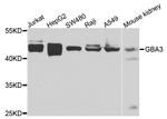 GBA3 Antibody in Western Blot (WB)