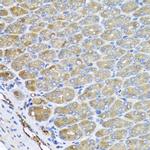 VPS37A Antibody in Immunohistochemistry (Paraffin) (IHC (P))