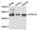 VPS37A Antibody in Western Blot (WB)