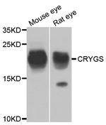 CRYGS Antibody in Western Blot (WB)