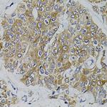 ARHGEF11 Antibody in Immunohistochemistry (Paraffin) (IHC (P))