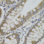 ARHGEF11 Antibody in Immunohistochemistry (Paraffin) (IHC (P))