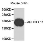 ARHGEF11 Antibody in Western Blot (WB)