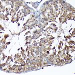 MTHFD1L Antibody in Immunohistochemistry (Paraffin) (IHC (P))