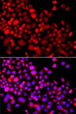 CALCOCO1 Antibody in Immunocytochemistry (ICC/IF)