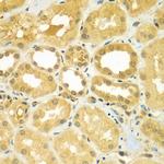 CALCOCO1 Antibody in Immunohistochemistry (Paraffin) (IHC (P))