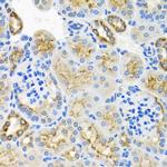 STX7 Antibody in Immunohistochemistry (Paraffin) (IHC (P))