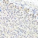 CNOT8 Antibody in Immunohistochemistry (Paraffin) (IHC (P))