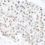 Centrin 3 Antibody in Immunohistochemistry (Paraffin) (IHC (P))