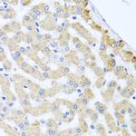 Centrin 3 Antibody in Immunohistochemistry (Paraffin) (IHC (P))