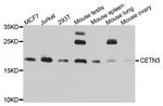 Centrin 3 Antibody in Western Blot (WB)