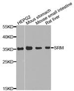 SRM Antibody in Western Blot (WB)