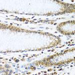 IFI44 Antibody in Immunohistochemistry (Paraffin) (IHC (P))