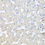 ARL6 Antibody in Immunohistochemistry (Paraffin) (IHC (P))