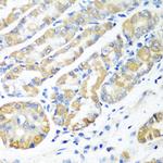 MSRB2 Antibody in Immunohistochemistry (Paraffin) (IHC (P))