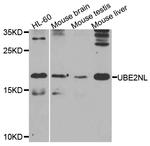 UBE2NL Antibody in Western Blot (WB)