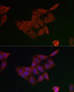 GCLM Antibody in Immunocytochemistry (ICC/IF)