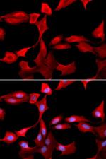 GCLM Antibody in Immunocytochemistry (ICC/IF)