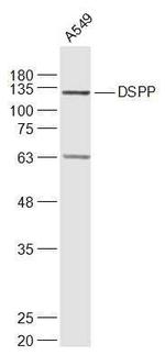 DSPP Antibody in Western Blot (WB)