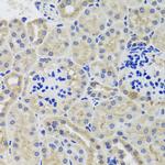 HK3 Antibody in Immunohistochemistry (Paraffin) (IHC (P))