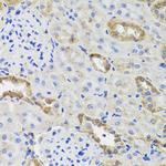 HK3 Antibody in Immunohistochemistry (Paraffin) (IHC (P))