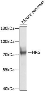 HRG Antibody in Western Blot (WB)