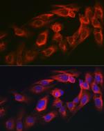 MYO10 Antibody in Immunocytochemistry (ICC/IF)