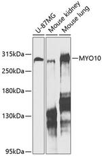 MYO10 Antibody in Western Blot (WB)