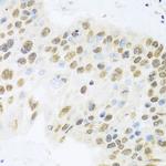 ZBTB17 Antibody in Immunohistochemistry (Paraffin) (IHC (P))