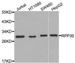 RPP30 Antibody in Western Blot (WB)