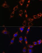 Aquaporin 8 Antibody in Immunocytochemistry (ICC/IF)