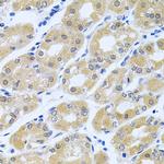 GNE Antibody in Immunohistochemistry (Paraffin) (IHC (P))